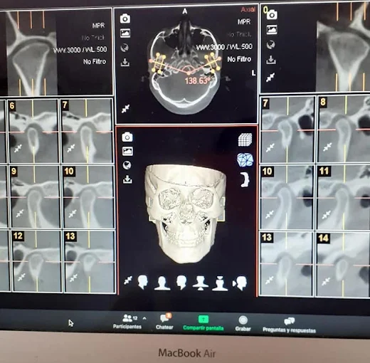 Healthy Smile | Odontología y Estética Facial con Ortodoncia, Implantes