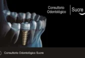 Odontología Sucre | Rehabilitación Oral Integral, Estética Dental