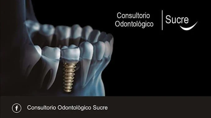 Odontología Sucre | Rehabilitación Oral Integral, Estética Dental