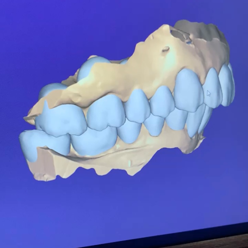 Centro Odontológico Baino | Implantes, Ortodoncia y Blanqueamiento