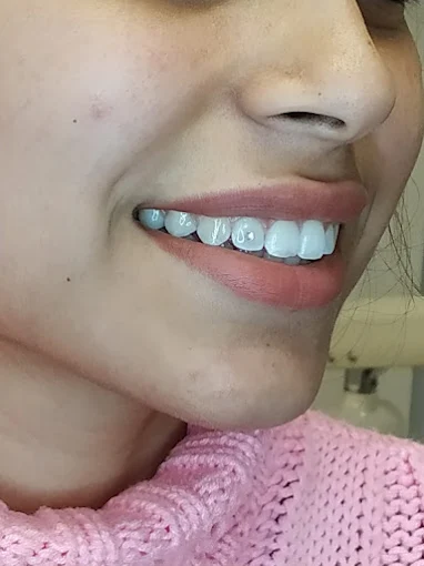 Odontología Nueva Córdoba – Bonetto y Rodiño | Odontología General