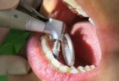Odontología Ahumada | Odontología Integral, Implantes, Ortodoncia