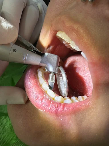 Odontología Ahumada | Odontología Integral, Implantes, Ortodoncia