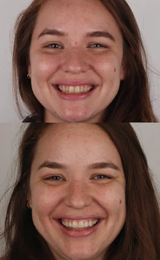 Odontología Stefanía Lecroq | Consultorio con Especialización en Estética Dental