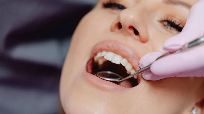 Uso Brackets | Ortodoncia y Estética Dental para Niños, Jóvenes y Adultos