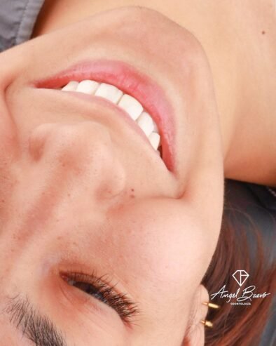 Angel Bravo Odontología | Taller con Odontología Integral