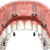 Valeria Herrera Odontología | Odontología de Calidad, Atención Personalizada, Estética