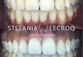 Odontología Stefanía Lecroq | Consultorio con Especialización en Estética Dental