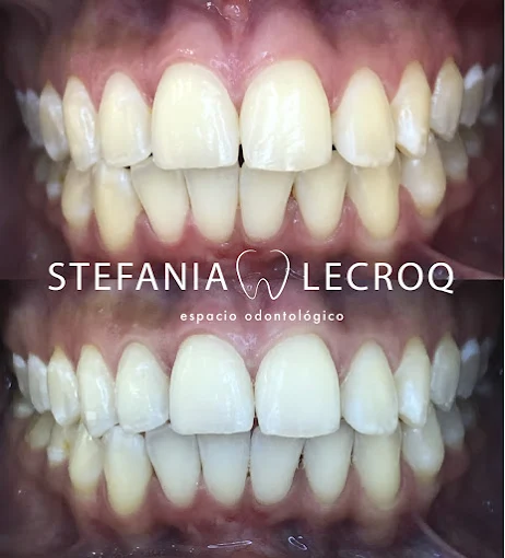 Odontología Stefanía Lecroq | Consultorio con Especialización en Estética Dental