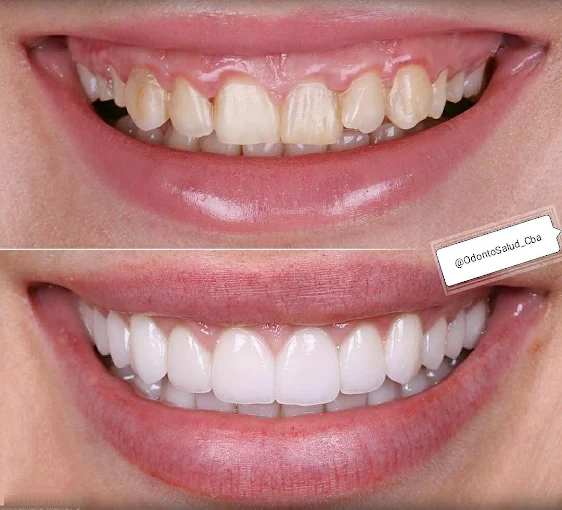 OdontoSalud Cba | Clínica Dental en Córdoba – Tratamientos de Excelencia, Seguridad y Confianza