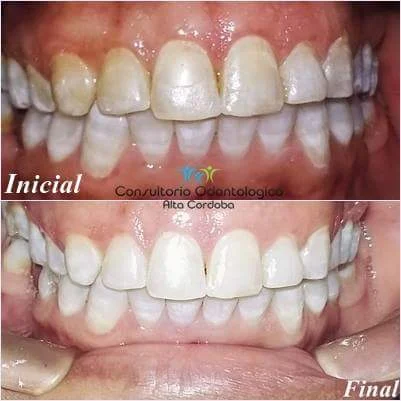 Consultorio Odontológico Alta Córdoba | Atención Integral para Niños y Adultos