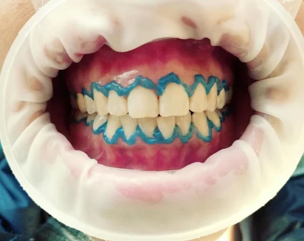 Odontología Sucre | Rehabilitación Oral Integral, Estética Dental