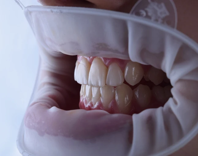 Concepto Sonrisa | Odontología con Tratamientos de Mínima Invasión para la Estética y Salud