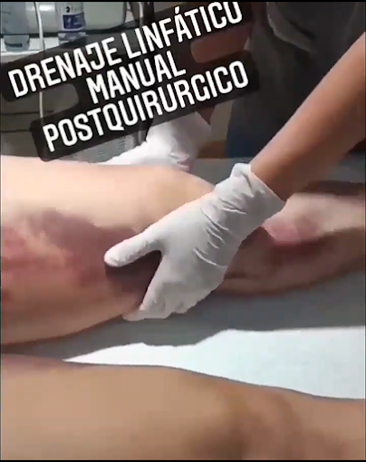 Kinesiología, Fisioterapia y Estética  DLM Postquirúrgico, Rehabilitación y Tratamientos Estéticos