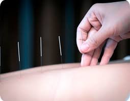 Medicina Tradicional China Dr. Ricardo | Acupuntura, TuiNa y Fitoterapia