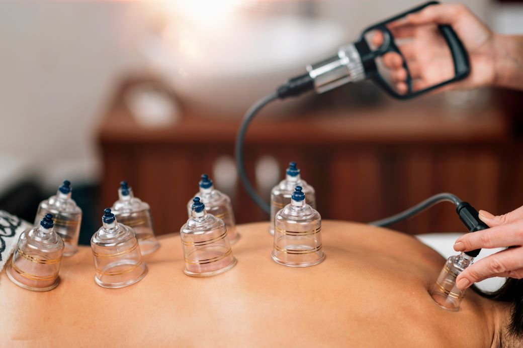 Donna Natura | Clínica de Acupuntura y Medicina China en Córdoba