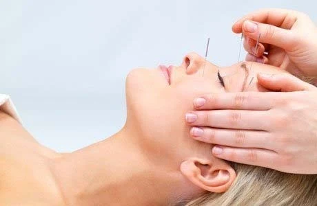 Acupuntura Tradicional China | Tratamiento del Dolor y Salud Integral